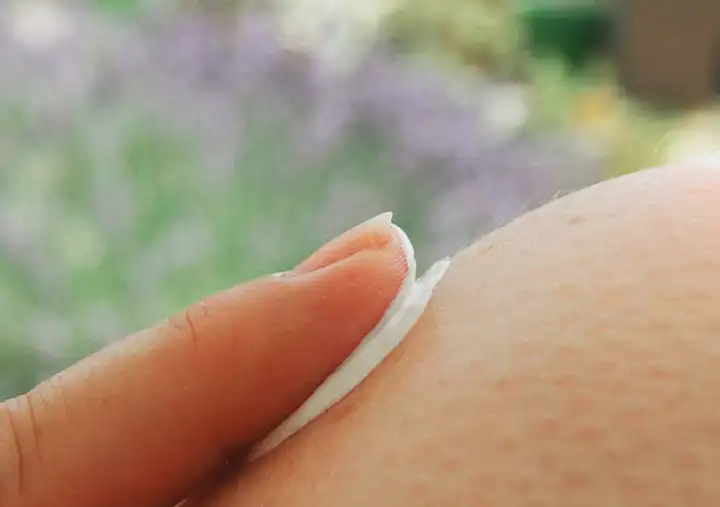 Alergia a hidratantes de pele de aveia | Causas e Sintomas