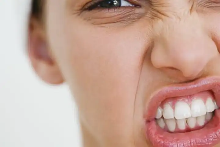 Bruxismo | Ranger ou apertar os dentes Bruxismo | Ranger ou apertar os dentes