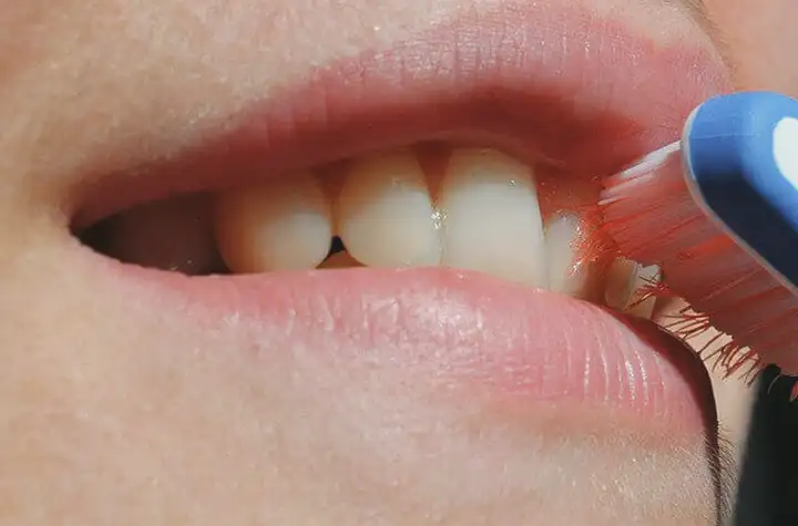 Câncer da boca | Uma ferida que não cicatriza