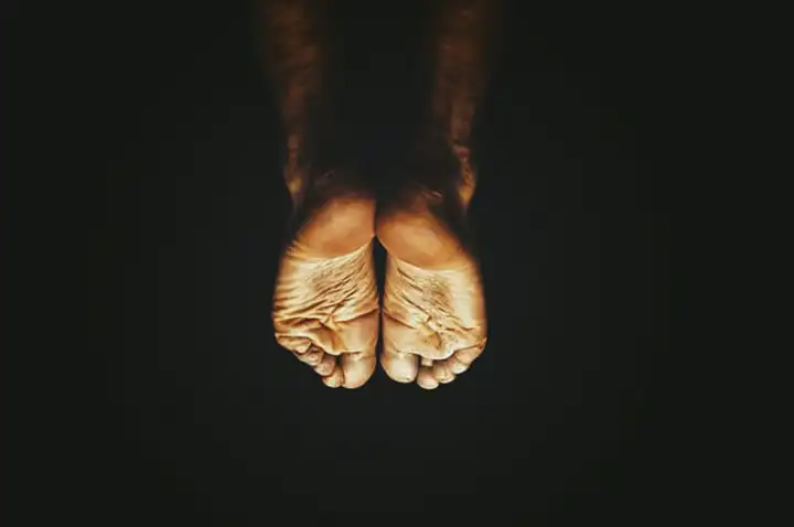 Coceira (comichão) nos pés durante o exercício