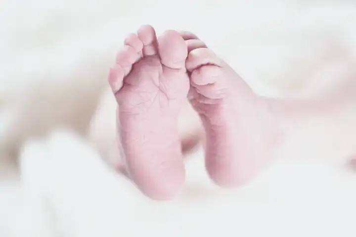 Como um bebê tem microcefalia?