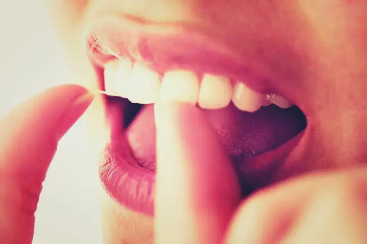 Gengiva Inflamada? Cuidado! A Gengivite Pode Causar a Perda de Dentes