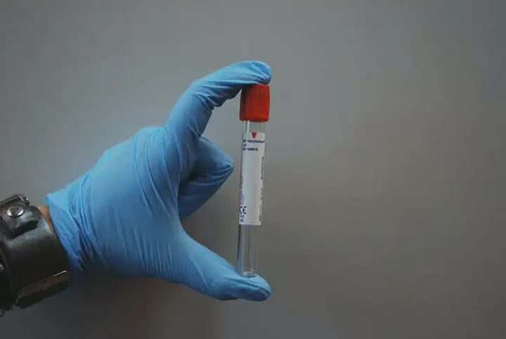 O que é um teste de sangue padrão?