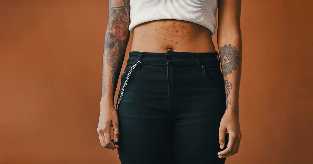 Remoção de tatuagem a laser: o que você precisa saber