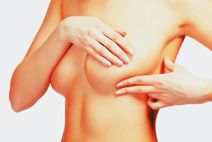 O que são seios fibrocísticos (tecido mamário ou glandular)
